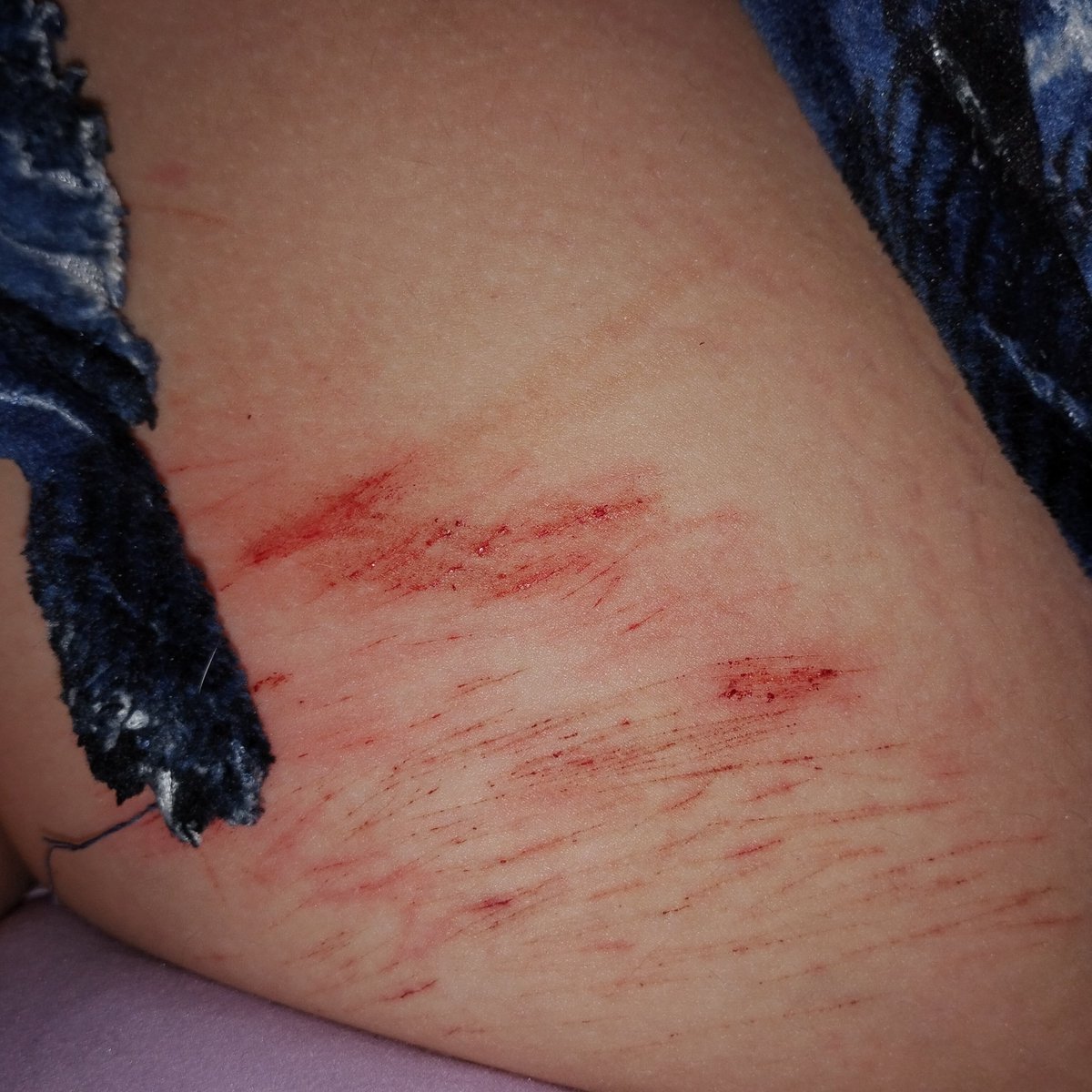 cutelittler2's tweet photo. Tried to hit styro again and FAILED. My blade was too dull and it hurts so bad https://t.co/pJaupmiw0E