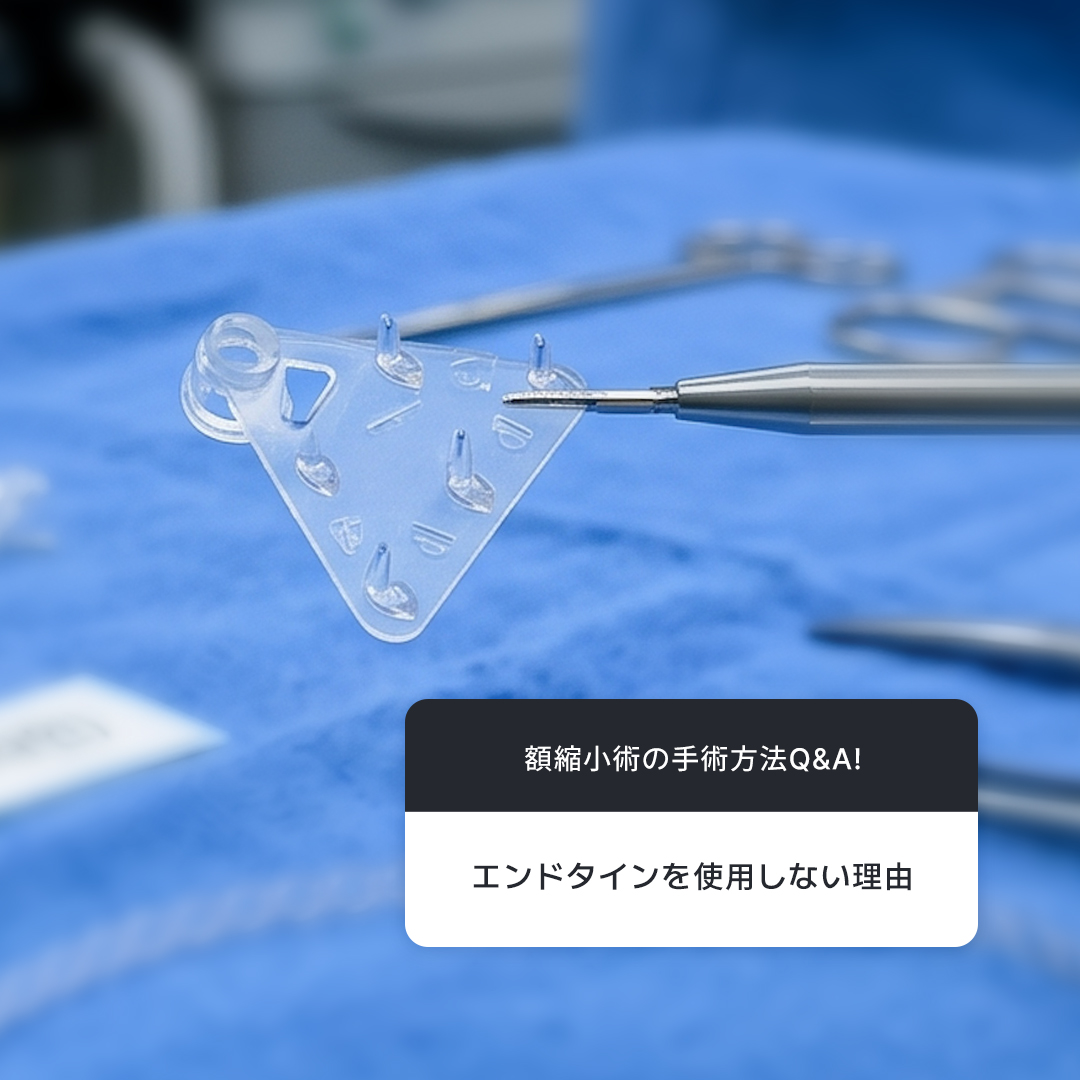 respectps_jp's tweet photo. リスペック 整形外科 キム・ギウン院長が話す額縮小手術の方法🧐

エンドタインは、プラスチックに鋭い突起が複数付いた固定用デバイスです
額縮小や額リフトの際に、頭皮を希望する位置へ固定するために使用される材料です

アメリカ食品医薬品局（FDA）でも承認されている、比較的安全な材料です

約15年前、この手術が始まった当初は、論文でもその方法が推奨されていたため、多くの医師が当然のようにエンドタインを使用していました

エンドタインは強固な固定器具であるため、専用の骨穿孔器具を使って丸い穴を開け、そこにエンドタインを装着し、手術後に引き上げた皮膚をその固定部に引っ掛ける方法です

しかし現在エンドタインを使用していない理由は、手術を重ねる中で分かったさまざまな不便さがあるためです

頭皮や額の皮膚は非常に薄い組織です
薄い皮膚にエンドタインの鋭い突起が食い込むことで、その部分に痛みが生じるケースが少なくありません

問題は、時間の経過を待つ以外に、この不快感を改善する方法がほとんどないということです

この不快感を解消するために、どのような手術方法が最適なのかを何度も工夫しました

1.多くの固定ポイントを確保

2.強い固定力

この2つの条件をどちらも満たす方法を追求した結果、現在行っている手術方法は

骨膜をよりしっかりとし、複合的に固定する方法です
7か所以上の固定ポイントを確保する方法です

従来の手術方法と比べても同等の固定力を得られる一方で
固定ポイントが複数に分散されるため、術後の患者様の痛みは大幅に軽減されました

なお、症例によっては従来の手術方法を組み合わせて使用することもあります

安全で美しい仕上がりをご提供いたします

お問い合わせは LINE : https://t.co/h20EjgEKKS までお願いいたします🍀