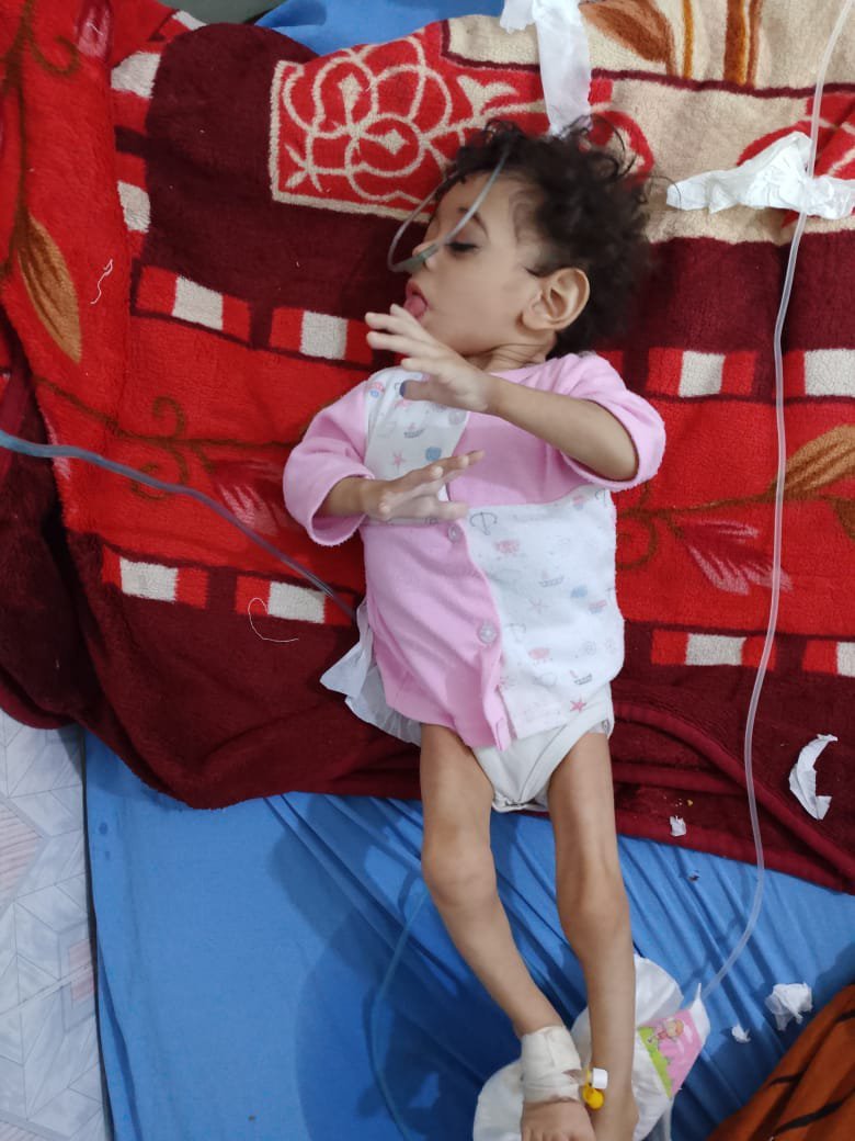 oliveegirl's tweet photo. Abeer is a Yemeni child. 🇾🇪
Little Abeer is in desperate need of help &amp; suffers from Cerebral Atrophy.
Her father, Abdulaziz wants to take her to Egypt 🇪🇬 for urgent treatment, but he requires money for travel and treatment.

Donate: https://t.co/SKlTV3jyKt

This is urgent. https://t.co/HJytMwi38I