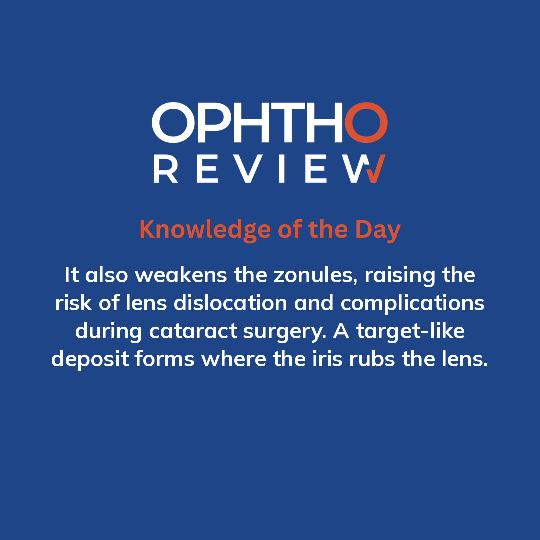 ophthoreview's tweet photo. Dandruff-like material

#ophthoreview #ophthalmology #ophtho #ophthalmologyresidency #ophthalmologist #surgicaleducation #medicaleducation #meded #surgery #medicalstudent #medicine #medicalschool #resident #residency https://t.co/ORKLqURpMN