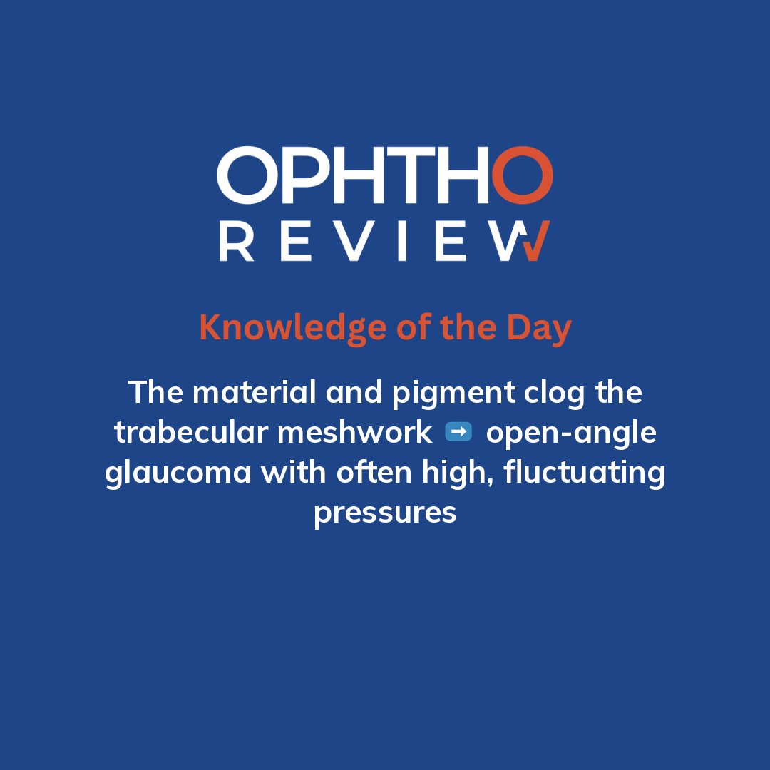 ophthoreview's tweet photo. Dandruff-like material

#ophthoreview #ophthalmology #ophtho #ophthalmologyresidency #ophthalmologist #surgicaleducation #medicaleducation #meded #surgery #medicalstudent #medicine #medicalschool #resident #residency https://t.co/ORKLqURpMN