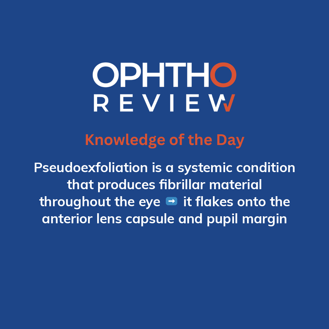 ophthoreview's tweet photo. Dandruff-like material

#ophthoreview #ophthalmology #ophtho #ophthalmologyresidency #ophthalmologist #surgicaleducation #medicaleducation #meded #surgery #medicalstudent #medicine #medicalschool #resident #residency https://t.co/ORKLqURpMN