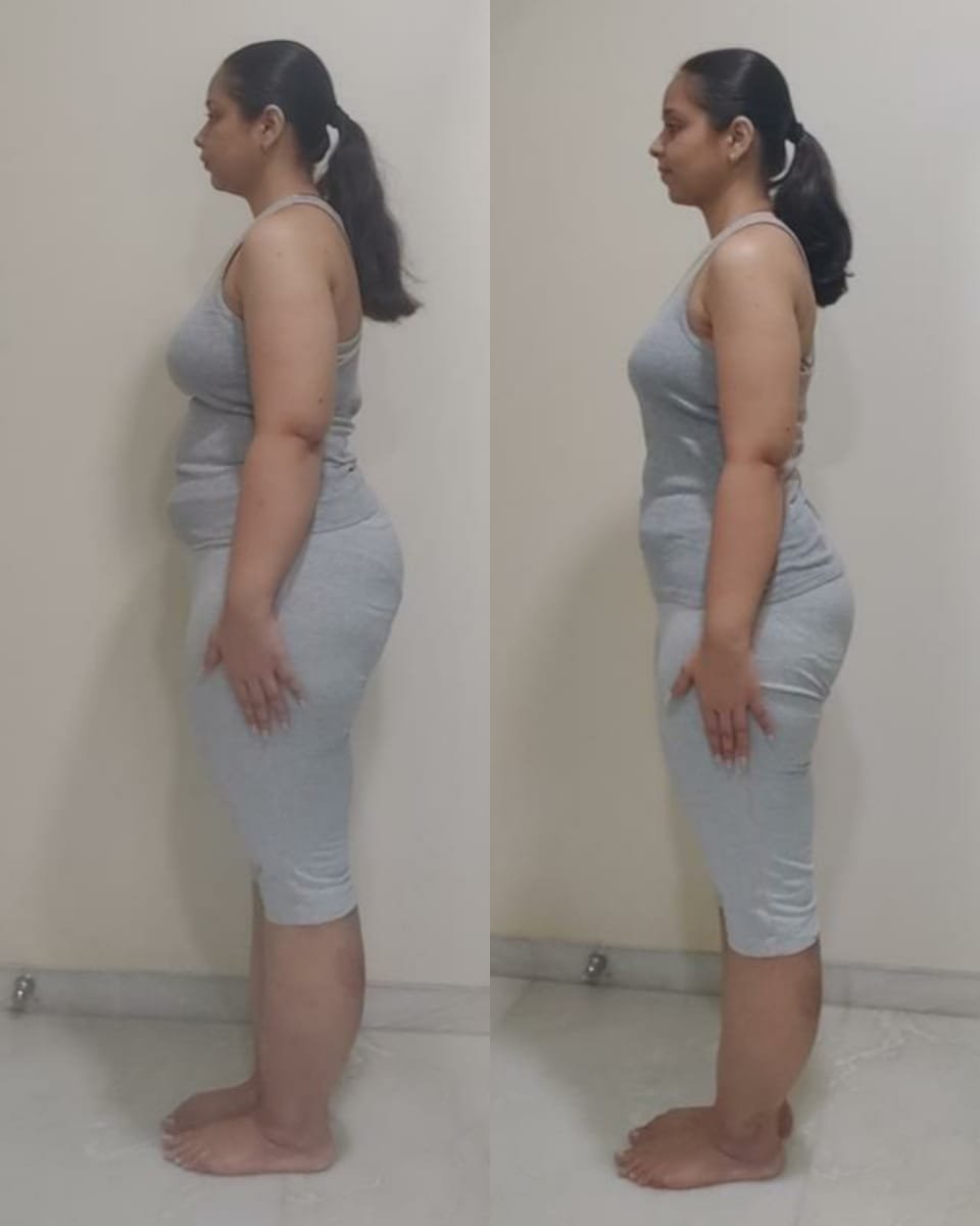 CoachBinita's tweet photo. She wanted to feel sexy, confident, and strong-not just lose weight.

So that's exactly how I designed her plan.

She stayed consistent, shared regular progress updates, and transformed from 82.5 kg to 68 kg, while losing over 40 inches overall.

Want to get stronger? DM "Coach" https://t.co/9QfnoOkfqi