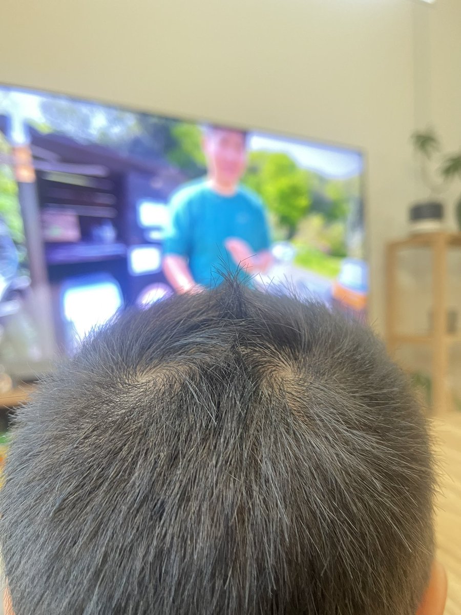 gon08031126's tweet photo. うちの次男は２つあるツムジの渦が真ん中で合流してプチモヒカンになってるのね https://t.co/O3C5RR0pTe
