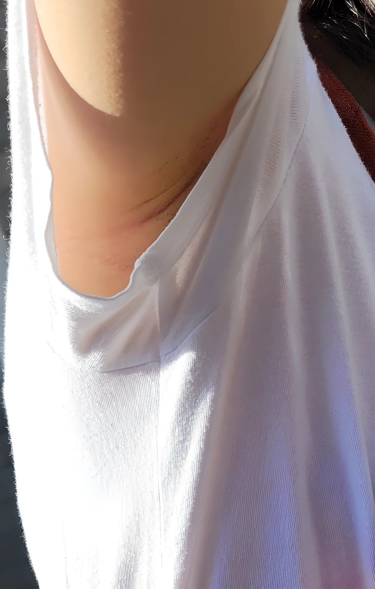 LlO1376767's tweet photo. Friend's armpit pictures πΈ
#axilas #underarms #women #gorgeous #sobaco #fetish #axilafetiche #axila #femalearmpits #nΓ‘ch #kilikili #aisselle #pheromones #겨λλμ΄ #ΰ€¬ΰ€ΰ€² #ΰΈ£ΰΈ±ΰΈΰΉΰΈ£ΰΉ #γγ #θ
δΈ #θ
ηͺ https://t.co/V3C8GrrXAB
