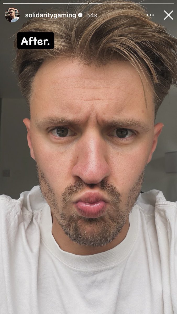 starborncats's tweet photo. the concept of jimmys hair not actually being in that perfect swoop all the time. who is jimmy solidarity without his swoop. wdym he styles it nah nah his hair is just like that, that’s how it comes straight out of the package https://t.co/tA4bHvhKf3