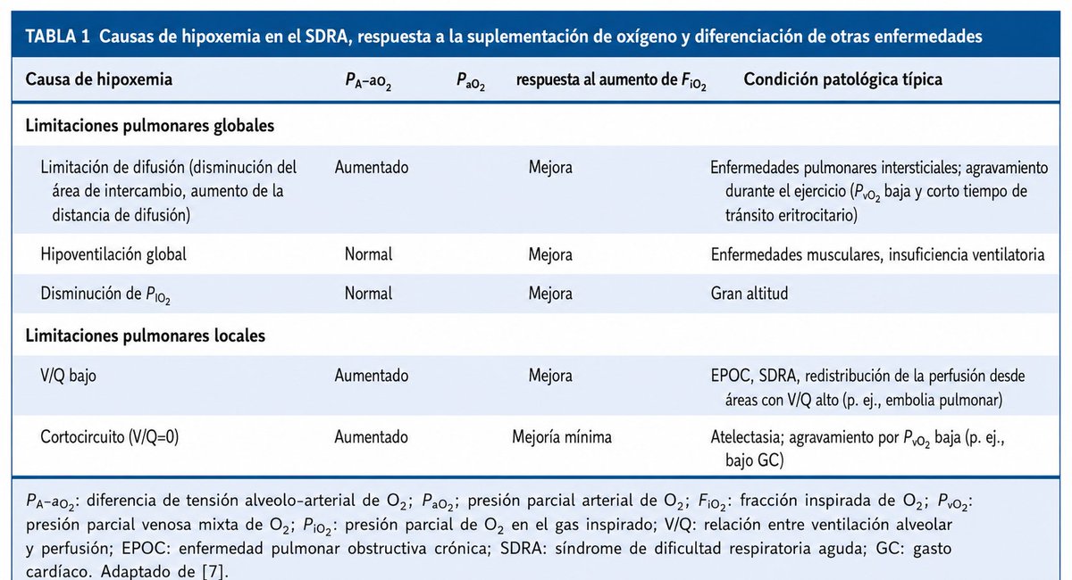 LeslieMegom's tweet photo. ☝🏻🤓Deterioro de la vasoconstricción pulmonar hipóxica en el SDRA👩🏻‍⚕️☕️
☕️La vasoconstricción pulmonar hipóxica (VHP) es un mecanismo fisiológico regional que contrae las arteriolas pulmonares próximas a alvéolos mal ventilados. 
🫁En el SDRA coexisten:
🔰Unidades alveolares colapsadas, inundadas o consolidadas regiones relativamente conservadas,lesión endotelial pulmonar,microtrombosis y obstrucción vascular,alteración heterogénea del tono vascular,
efectos variables de la PEEP y de la presión transpulmonar.🫁
☝🏻🤓En condiciones normales, la hipoxia alveolar regional debería disminuir⬇️ la perfusión de las zonas NO ventiladas. Sin embargo, cuando la VHP falla, parte del gasto cardiaco continúa atravesando unidades con ventilación mínima o nula...Por tanto, la gravedad de la hipoxemia no depende únicamente de cuánto pulmón está aireado, sino también de cómo se distribuye el flujo sanguíneo pulmonar.🫁
Pero 🤔¿Por qué se deteriora la VHP?
1️⃣. Lesión endotelial difusa
🔺️El endotelio pulmonar regula el equilibrio entre sustancias vasoconstrictoras y vasodilatadoras. 🔺️En el SDRA, la inflamación, el estrés oxidativo y el daño endotelial alteran las vías del óxido nítrico, prostaciclina, endotelina y especies reactivas de oxígeno.
☝🏻🤓Esto puede producir respuestas paradójicas:
▪️Pérdida de vasoconstricción en ▪️regiones hipóxicas.
Vasoconstricción excesiva en otras zonas.
▪️Aumento global de la resistencia vascular pulmonar.
▪️Distribución heterogénea e ineficiente del flujo.
☝🏻🤓La evidencia contemporánea reconoce que el SDRA es simultáneamente una enfermedad alveolar, endotelial y vascular. 
2️⃣. Inflamación y mediadores circulantes
🫁La sepsis, causa frecuente de SDRA, puede inhibir la VHP mediante mediadores inflamatorios, endotoxinas, óxido nítrico inducible y disfunción del músculo liso vascular.🫁
🔴La respuesta deja de ser exclusivamente regional: los mediadores circulantes afectan también vasos próximos a alvéolos bien ventilados, reduciendo la capacidad de redistribuir selectivamente la perfusión.
3️⃣. Microtrombosis y obstrucción vascular
🔵La activación de la coagulación, la inmunotrombosis y la lesión endotelial generan obstrucción vascular irregular. Algunas regiones ventiladas pueden quedar hipoperfundidas, mientras que otras, peor ventiladas, mantienen un flujo relativamente elevado.
☝🏻🤓Esto crea una combinación compleja:
▪️shunt: perfusión sin ventilación;
▪️Espacio muerto💀: ventilación sin perfusión;
▪️Aumento de la resistencia vascular pulmonar🫁
▪️Sobrecarga del ventrículo derecho.
4️⃣. Efectos farmacológicos
La VHP puede disminuir con:
●Vasodilatadores sistémicos.
●Anestésicos inhalados.
●Algunos inotrópicos y vasopresores, dependiendo de dosis y contexto.
●Alcalosis marcada.
●Concentraciones elevadas de oxígeno.
●Mediadores vasodilatadores generados por la inflamación.
🔴Los efectos no son uniformes ni completamente predecibles en el SDRA.🫁
5️⃣. Ventilación mecánica y volumen pulmonar
🔴La relación entre volumen pulmonar y resistencia vascular pulmonar tiene forma de U:
➡️A volúmenes bajos, el colapso comprime vasos extraalveolares;
➡️A volúmenes altos, la sobredistensión comprime capilares alveolares.
🔴Cerca de la capacidad residual funcional, la resistencia suele ser menor.
🔴Por ello, la PEEP puede tener efectos opuestos:
🅰️Cuando recluta alvéolos, reduce hipoxia regional, shunt y vasoconstricción hipóxica.
🅱️Cuando sobredistiende, aumenta la resistencia vascular pulmonar y la poscarga del ventrículo derecho.🫀
🫁En el SDRA, reclutamiento y sobredistensión suelen coexistir, por lo que la respuesta vascular a la PEEP es individual. 
⚠️Consecuencias clínicas
⛔️Hipoxemia desproporcionada
🛌Un paciente puede presentar hipoxemia profunda a pesar de conservar una proporción relevante de pulmón aireado, si el flujo sanguíneo se dirige preferentemente hacia regiones no ventiladas.🫁
❌️Mala respuesta al oxígeno
🔰En el shunt verdadero, elevar la FiO₂ mejora poco la oxigenación porque la sangre 👇🏽