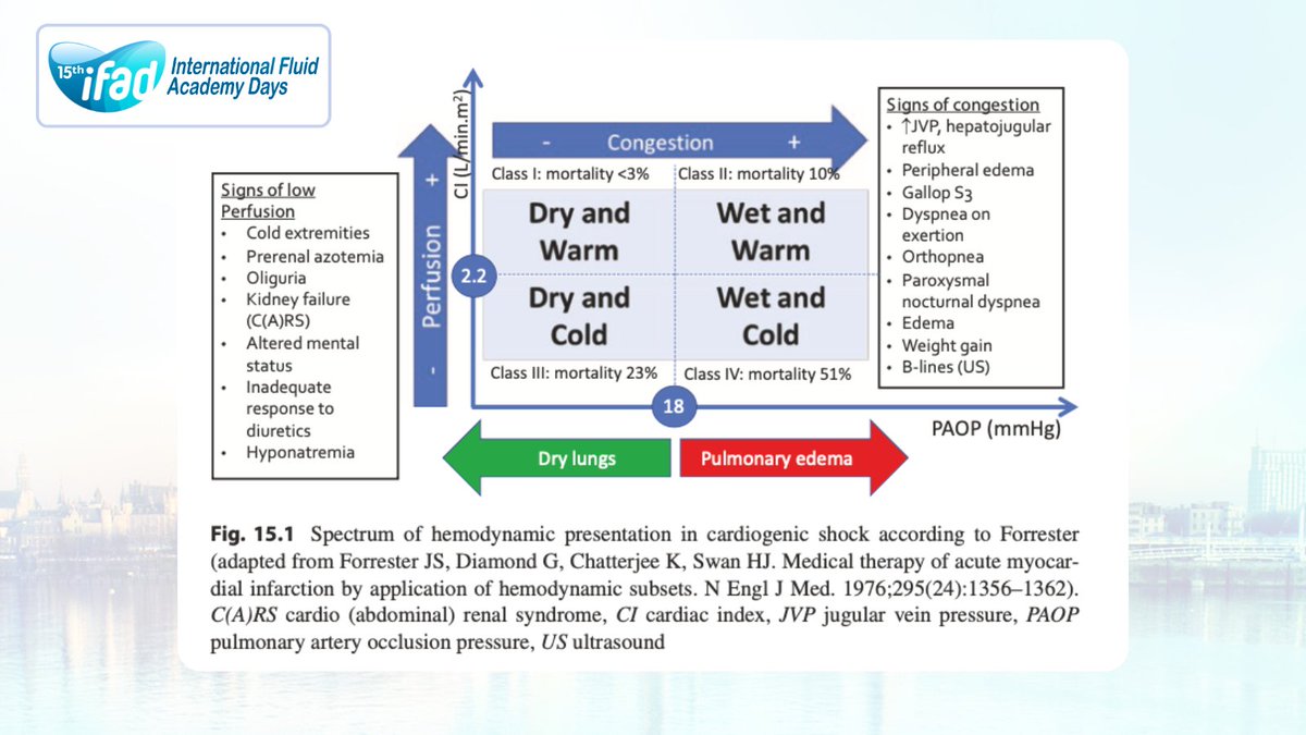 Fluid_Academy's tweet photo. Fluid Management in Cardiogenic Shock

This chapter discusses cardiogenic shock, a common condition encountered in the ICU. Cardiogenic shock results from decreased cardiac output and manifests as end-organ ischemia. The key diagnostic criteria for cardiogenic shock are identified, and the different clinical presentations of left and right heart failure are described. Fluid management in patients with an impaired cardiac function is complex, and clinicians traditionally titrate fluid therapy based on central venous pressure and clinical examination. However, there may be an overemphasis on fluid restriction in patients with heart failure, and physicians need to identify the subgroup of patients with cardiogenic shock who might actually benefit from fluid replacement. Fluid boluses need to be titrated to specific end points of end-organ perfusion guided by dynamic measures of fluid responsiveness and repeated echocardiographic assessments. While the pulmonary artery (PA) catheter continues to be the gold standard in assessing hemodynamics and fluid requirements in these patients, less invasive or noninvasive modes have shown potential in providing equivalent information without the risks associated with the PA catheter. Understanding the etiology and type of heart failure is crucial in providing additional information and the likelihood of a favorable response to fluid resuscitation. Take-home messages include the importance of identifying different subtypes of cardiogenic shock and etiology, the definitive role of ultrasound and other invasive or noninvasive hemodynamic monitors to guide fluid management, and the need for carefully titrated fluid boluses to specific end points in patients with impaired cardiac function.

🗓️ Full scientific programme: https://t.co/yKsyXzsZJ3
📍Registration: https://t.co/wATwBWAIge