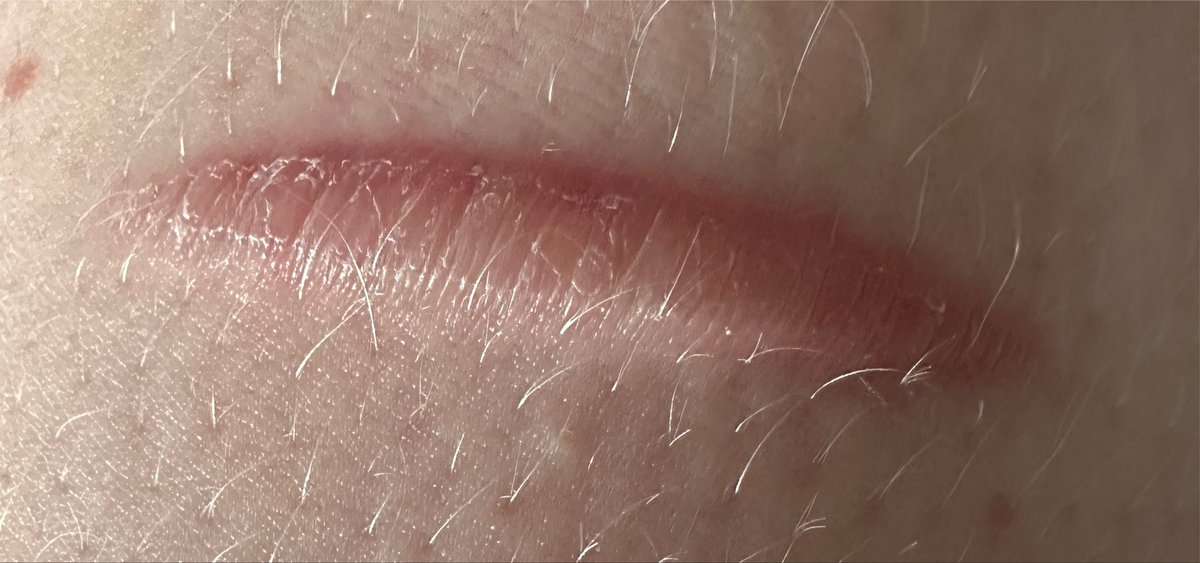 JaneM995's tweet photo. I feel like cutting again ngl I just cba to cope anymore with life 

Full update tho this cut is nice and clean again https://t.co/Gvb9CdyvMj