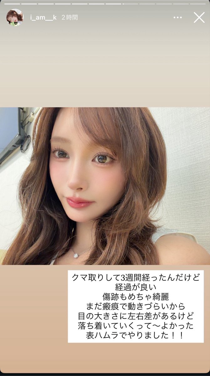 m_b_d_f_00's tweet photo. ジャングル東京きほちゃん
埋没、鼻、表ハムラの執刀医💉 https://t.co/yWLOeESPDk