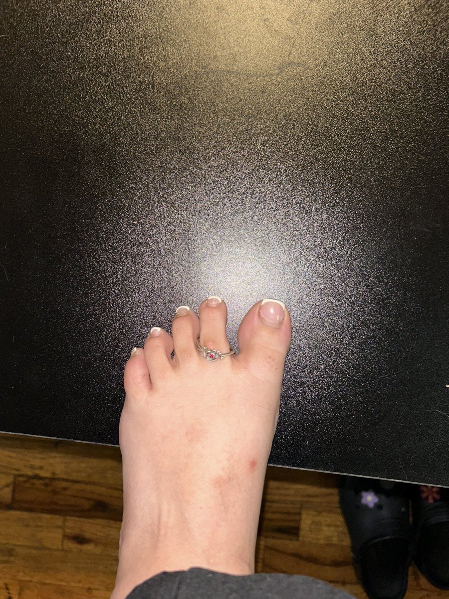 DuhJenei's tweet photo. Who wants to pay for my breakfast?? 
Cash App $paintwithjay
#feetfetısh #feetworshi̇p #piggies #toering https://t.co/wIONLs7nAW