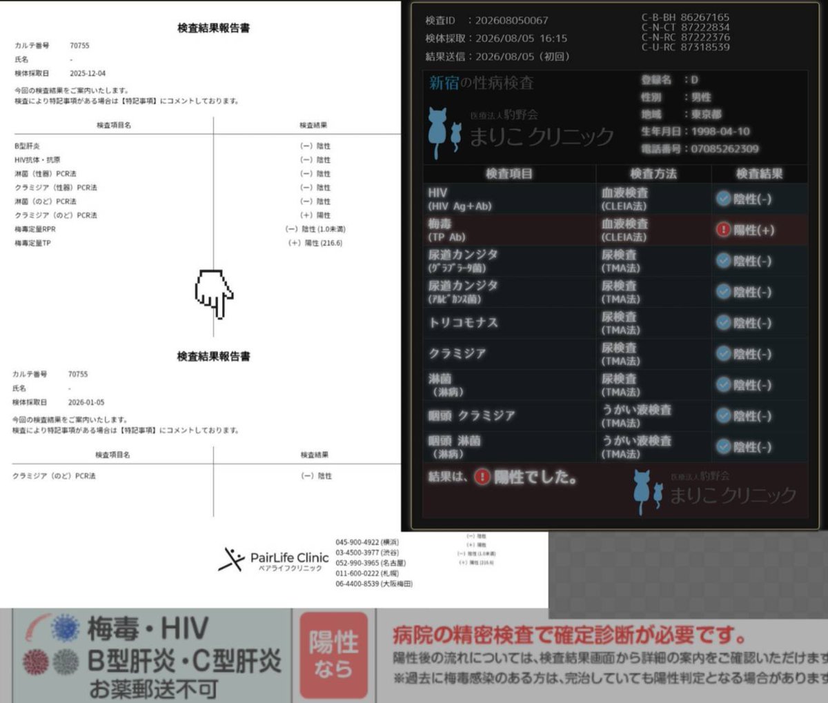 dasimaki77's tweet photo. 性病検査結果。無問題でした

※既に完治していますが、梅毒はRPR法は陰性。だがTP法だと今がどうであれ陽性結果になります。 https://t.co/46HrgmXNbf