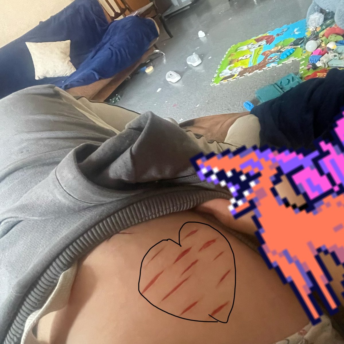 mapeltastic's tweet photo. THIS IS FOR MAKEUP SFX, I MADE IT MYSELF !

it’s a heart! also i had to cover my hand with netskie laughing, so don’t mind it
#styrotwt #shtなりきりさんがrtしてくれてそれを見たshtなりきりさんがきっとフォローしてくれる #sharm #ouchie #crap https://t.co/w40bSqLCmh