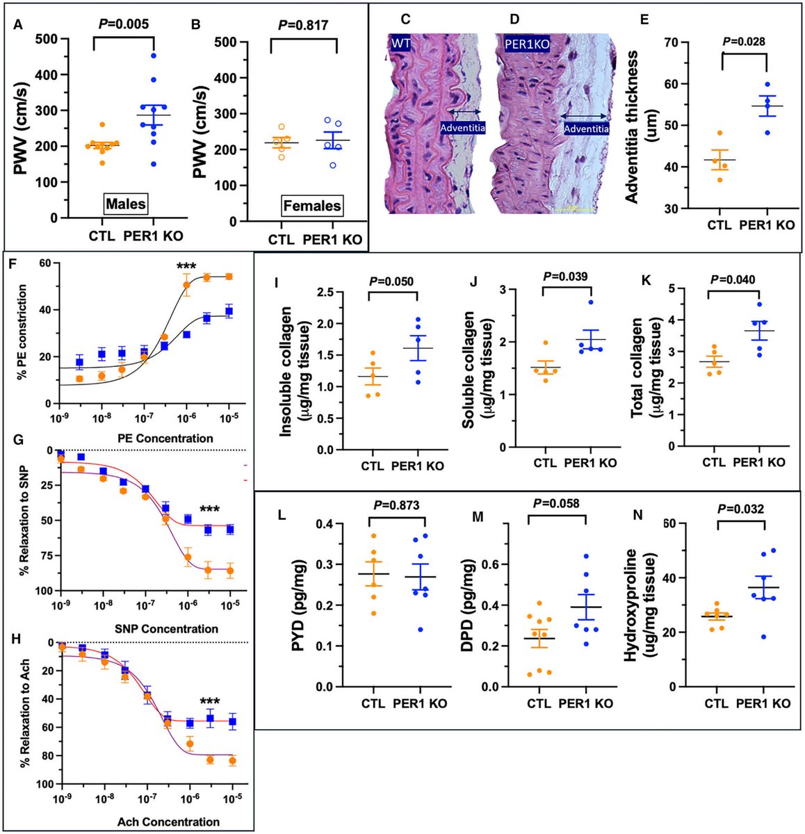 JAHA_AHA's tweet photo. Is circadian rhythm a hidden driver of sex-specific CV risk?

Male mice lacking the circadian clock gene PER1 develop stiffer arteries and thickened vessel walls, but females show no difference. #ResearchLetter @DrSharma_RK https://t.co/o3dmWKr10a https://t.co/rwDYthtdql
