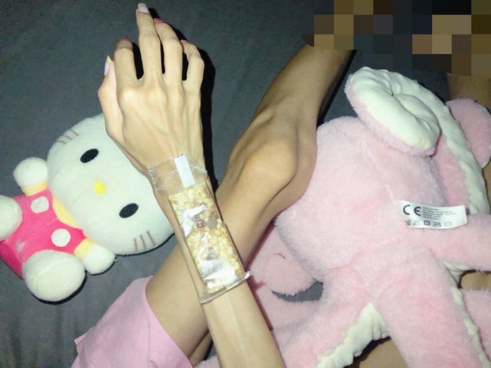 uniwonylove's tweet photo. leg &amp; wrist bc // i cant stand living w this much fat anymore https://t.co/RVc7gpSUKv