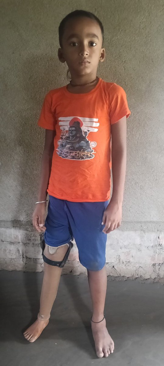 tulsighata's tweet photo. A prosthetic leg can change a life. Ranjit Gayen now walks to school with confidence after receiving his 3rd prosthetic limb through Tulsighata Sankalpa Trust.
Help us build a Rural Artificial Limb &amp; Rehabilitation Centre in the Sundarbans.
📞 +91 73842 72386 | +91 96749 85132 https://t.co/WVRtdatDg7