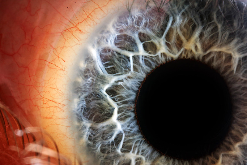 Macropods's tweet photo. Most people never get to look this closely at an eye. This self-captured blue iris has a live high-resolution viewer: pan and zoom through the detail. https://t.co/RleymhQQQE #ScientificImaging #Microscopy https://t.co/3Tx7wo3WmQ