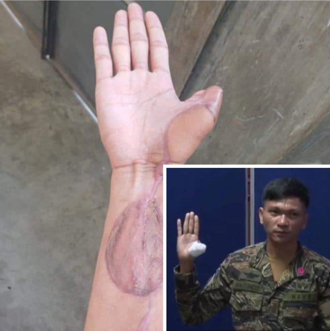 adi_vijaya's tweet photo. This is China's language of peace, bullying and injuring sailors of tiny Nations at Sea. 

When it comes to twisting narrative, China starts acting like a victim. @ChongJaIan https://t.co/saSQkrGC2C
