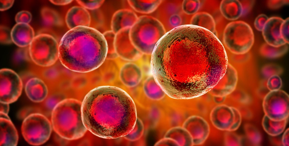 MStranslate's tweet photo. Data from a Phase 1 trial of people living with progressive #MultipleSclerosis has suggested that treatment with fetal neural stem cells is safe &amp; could provide neuroprotective benefits. #MS [1/2] https://t.co/9kUpxDiPyz