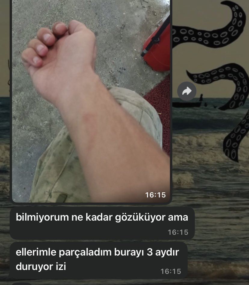 miyavmiyavnigua's tweet photo. nolur kendıne zarar verme🥺🥺 https://t.co/NsWLcdQ0DB