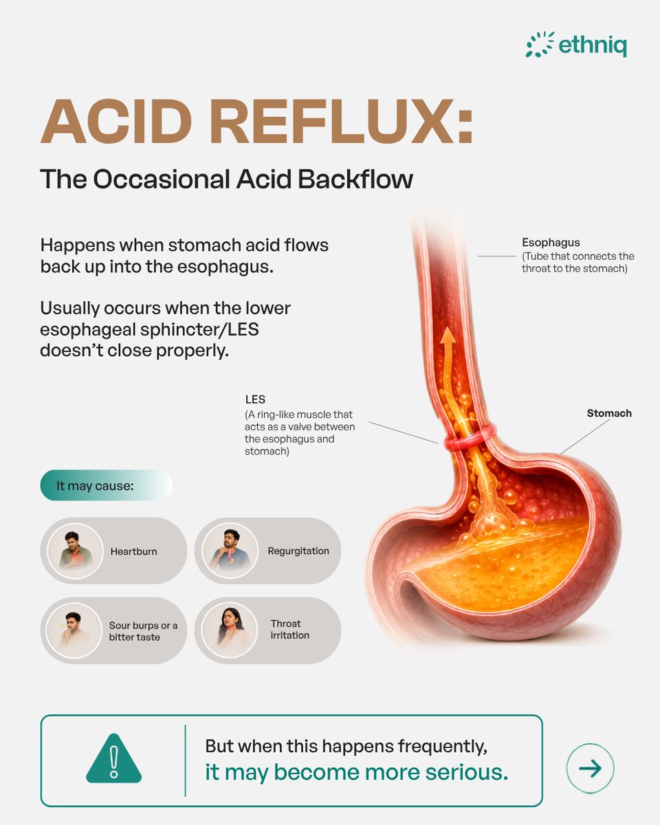 ethniqmed's tweet photo. Acid Reflux &amp;GERD are not the same!
 
Acid reflux is an occasional backflow of stomach acid into the food pipe. But when it starts happening frequently, it may be a sign of GERD.

Understanding the difference is the first step towards taking better care of your digestive health. https://t.co/9SrNFkl5Rm
