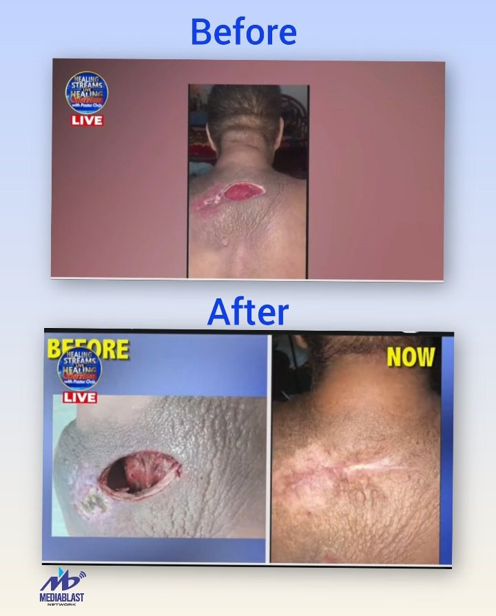 AFG_0007's tweet photo. Only JESUS CHRIST can do this 🙇🏾‍♂️🙇🏾‍♂️

Testimony from the HEALING STREAMS LIVE HEALING STREAMS with Pastor Chris 🔥🔥 https://t.co/f3FSItc0YI
