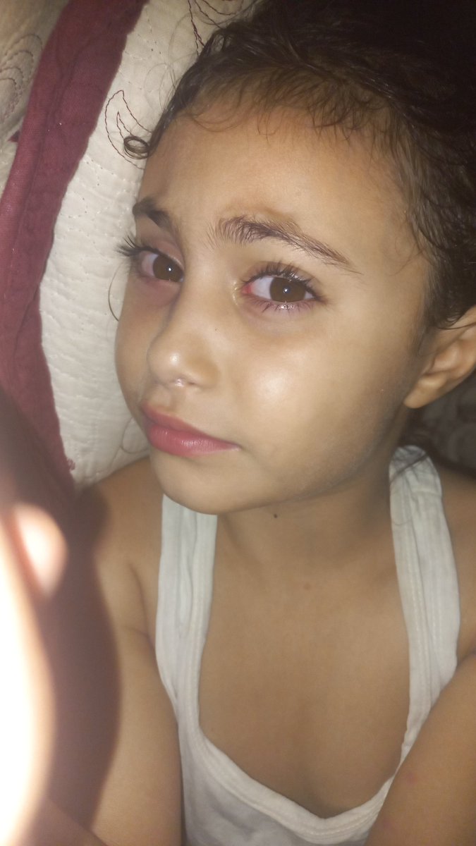 amany_alhdad32's tweet photo. My daughter Samran is still suffering from a high fever, and I am still unable to afford her treatment. 😭💔
Only $132 remains to cover the cost of her treatment. Please help me. I can't bear to see my little girl continue suffering without the medicine she needs. 🙏💔 https://t.co/BWohsB6Jvo