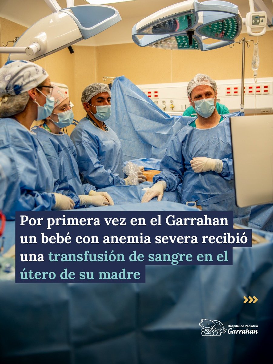 HospGarrahan's tweet photo. NUEVO PROCEDIMIENTO EN EL GARRAHAN: REALIZAMOS LA PRIMERA TRANSFUSIÓN A UN BEBÉ EN EL VIENTRE DE SU MADRE 

Nuestros médicos llevaron a cabo la primera transfusión intrauterina a un bebé de 26 semanas de gestación con anemia fetal severa, incorporando una nueva práctica de alta complejidad. 

El tratamiento busca reducir la anemia y el riesgo de complicaciones graves, como el hidrops fetal -acumulación de líquido en dos o más cavidades del feto-, insuficiencia cardíaca, e incluso la muerte.  

El procedimiento, guiado por ecografía, implicó un verdadero trabajo interdisciplinario de equipos de neonatología, obstetricia, cirugía general, medicina transfusional y laboratorio.  

La inversión en tecnología de última generación y la capacitación permanente de nuestros profesionales permiten ampliar las capacidades del Garrahan y avanzar hacia el objetivo de consolidarnos como el mejor hospital de América Latina.