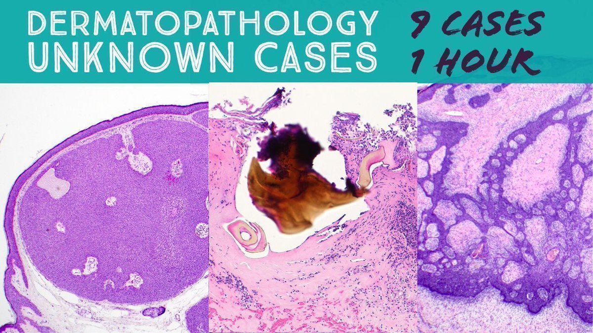 JMGardnerMD's tweet photo. Random #dermpath unknown cases. Some really fun ones in this set! 
video: https://t.co/mfhAzvLSiI 
#pathology #pathologists #pathTwitter #dermatology #dermatologia #dermtwitter https://t.co/cK84gik0YK