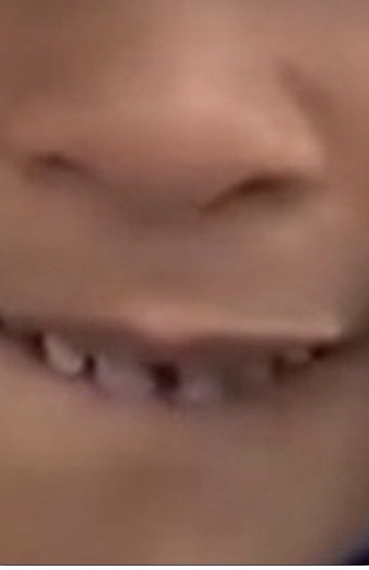 FellowAlijah's tweet photo. @He_is_darkskin Gummy Smile Vs Dirty Unbrushed Nasty Wide Gap Shark Mouth Interstate Highway Road Wide https://t.co/sNmVFK59IJ