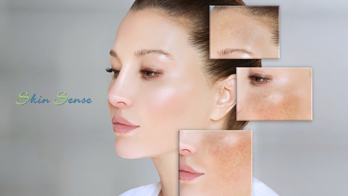 skinsensema's tweet photo. Your skin is unique, and your skincare should be too. From #dryskin and #acne to other concerns, we provide customized skincare solutions designed around your specific needs to help you achieve healthier, more confident-looking skin.

#SkinTreatment #SkinCare https://t.co/YhhPcilJZb
