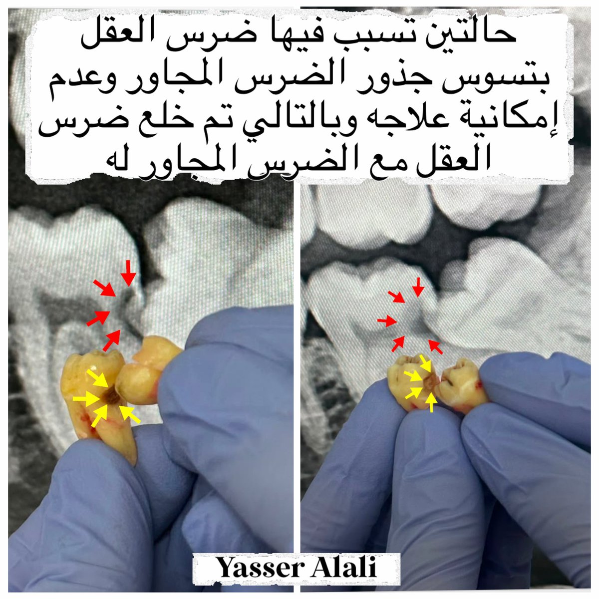 AlaliYasser966 tweet picture