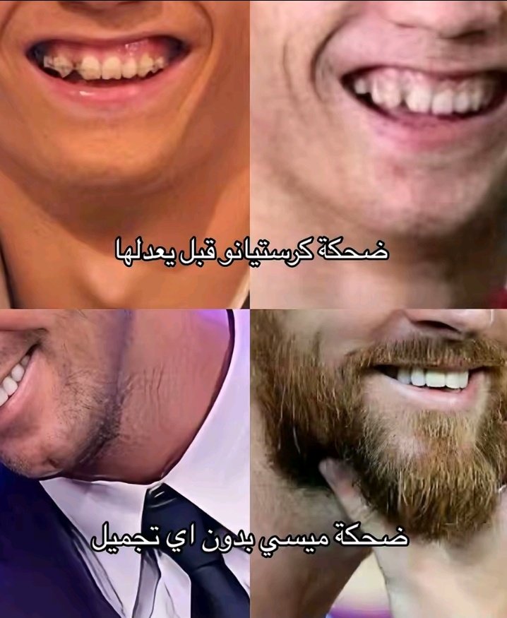 not8em's tweet photo. مشكلة ميسي ما يخضع للعمليات و يتمكيج قبل كل مباراة https://t.co/e78hMQCzt9
