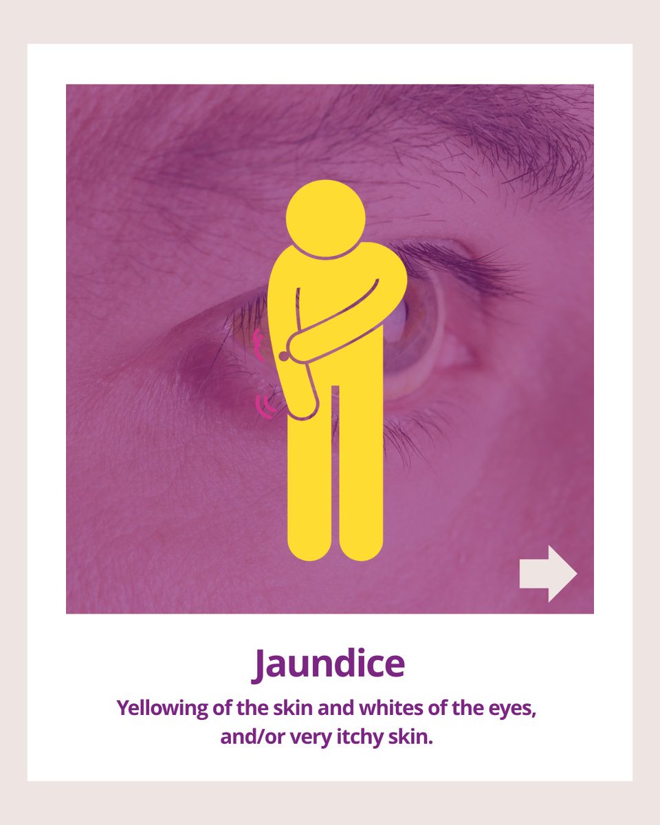 OfficialPCA's tweet photo. 💜 Would you recognise the signs of pancreatic cancer?

By learning the signs and sharing them with others, you could help someone seek medical advice sooner.

Learn more:
https://t.co/yT9xJd1L6b https://t.co/sIkfNEafJ8