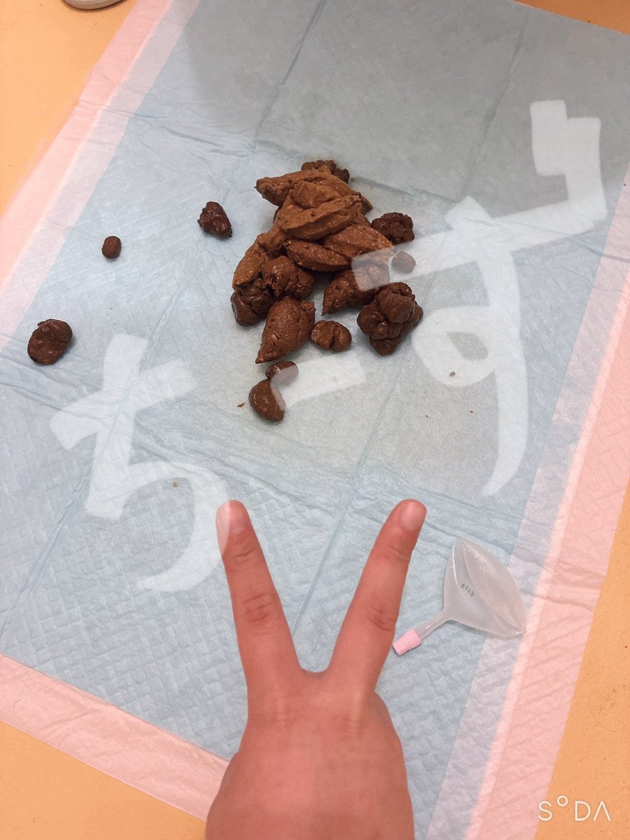 cheese_pip's tweet photo. 1個目普通に💩
2個目その後に浣腸💩
写真✌️ https://t.co/hrrZ4hcaV8