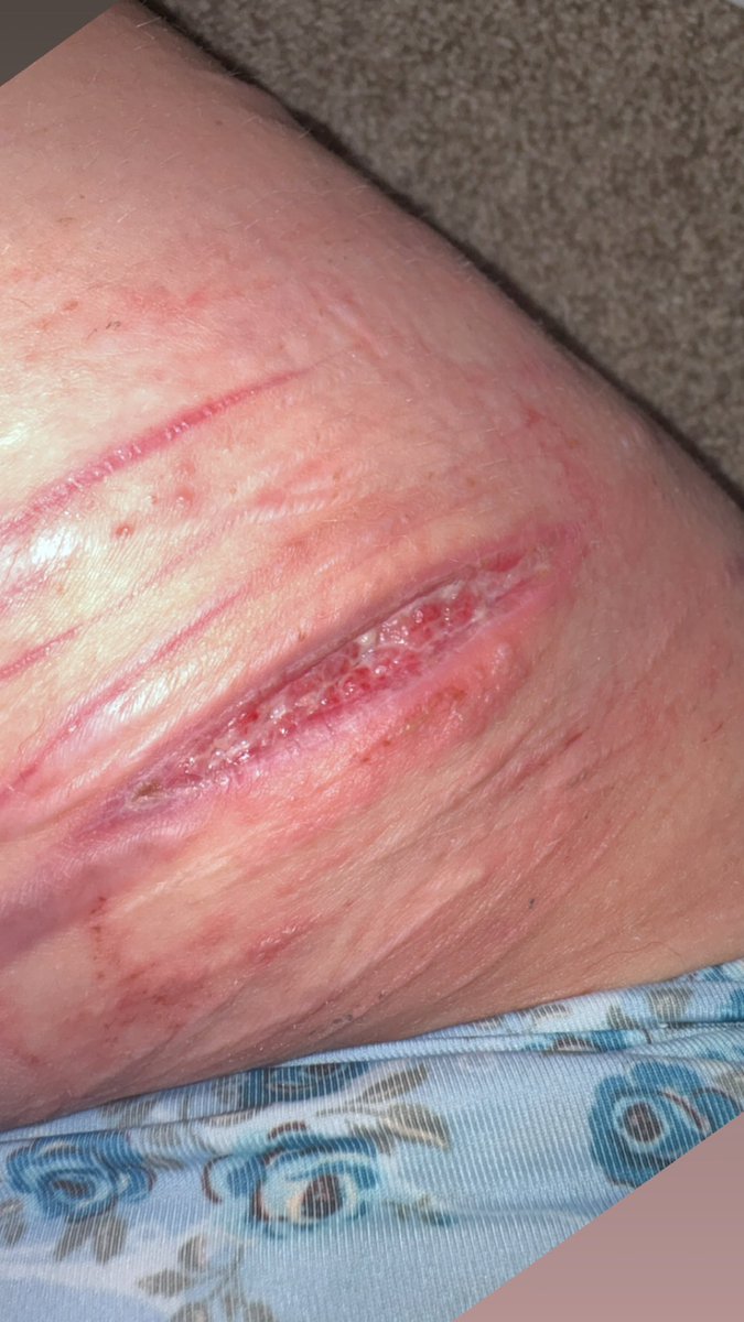 iPlayFruitNinja's tweet photo. 2 Weeks old today !! meaning 2 weeks clean 🥳

SFX MAKEUP FAKE 
#shtwt #slitwt https://t.co/bGzZGuL2Vr