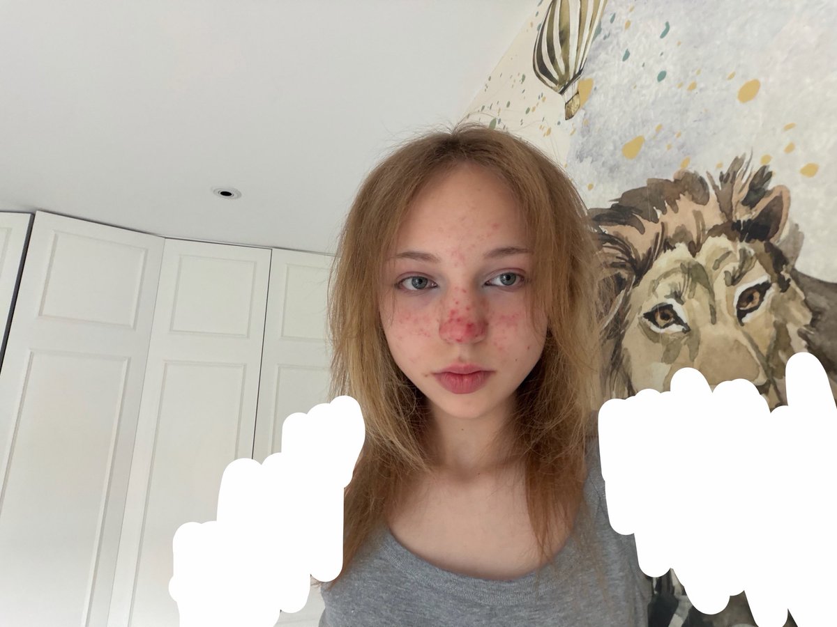 lSillytwt's tweet photo. Bothered with hair and makeup for the first time in a while. Censoring my arms because I’m scared of them looking fat

+Bodychecks. I really hope I haven’t gained :( https://t.co/NMrwZd19Zd