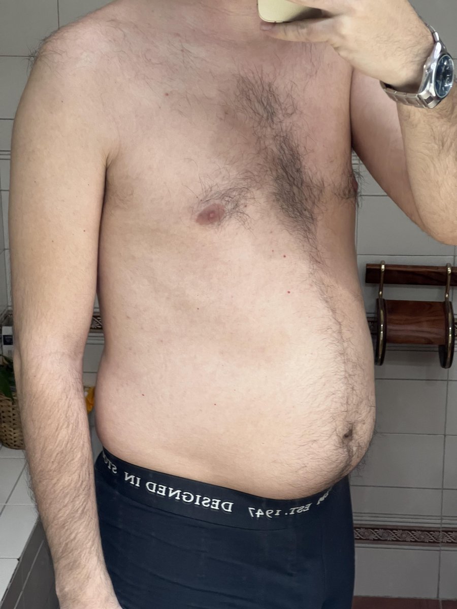levelsio's tweet photo. Essentially most guys over 35+ now have this body or worse

You really have to fight this and become ripped to avoid this fate, which means being strict on nutrition and exercise

I call it the "padel body": skinny limbs and a fat beer belly, others call it "pregnant guy" which I like too 😂

It's very risky because belly fat (or visceral fat) is uniquely dangerous: it actively disrupts your hormonal system (which makes you depressed or if you're a guy feminine and if you're a woman masculine), as well as causing body-wide inflammation, heart disease, diabetes and even strokes!

Don't believe me?

🇺🇸 US: Roughly 70% to 77% of adult men over age 35 are overweight or obese, according to national health data from the Centers for Disease Control and Prevention and the National Health and Nutrition Examination Survey. Rates increase significantly with age, peaking during middle age

🇪🇺 EU: Roughly 60% to 80% of middle-aged and older men in Europe are overweight or obese. Data from the World Health Organization Regional Office for Europe and Eurostat show that weight-gain heavily scales with age, with male rates consistently higher than female rates