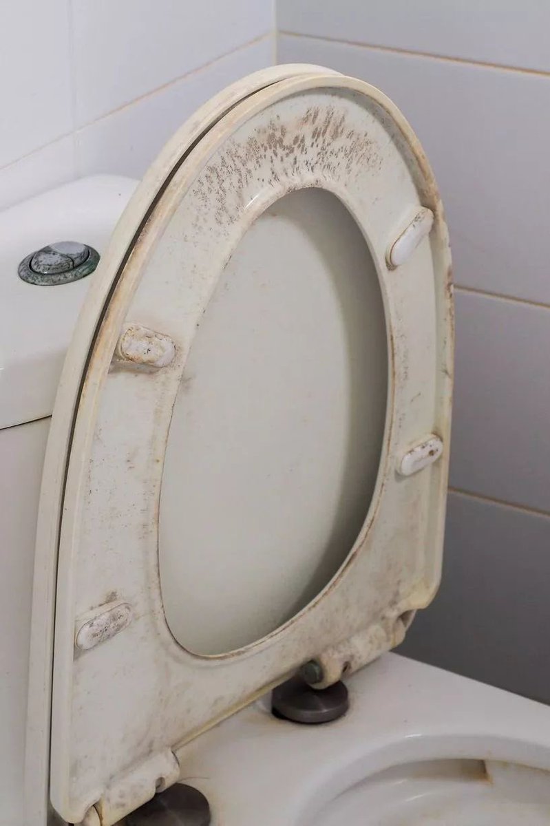 Elifbenad's tweet photo. Tuvaletde bu sarı kirler neden oluşur..ne kadar yıkasam bu sarı kirler gitmiyor ne neden oluyor bilgisi olan var mı ?? Ne yapabilirim geçmesi için ?? https://t.co/gWBgwfvFCq