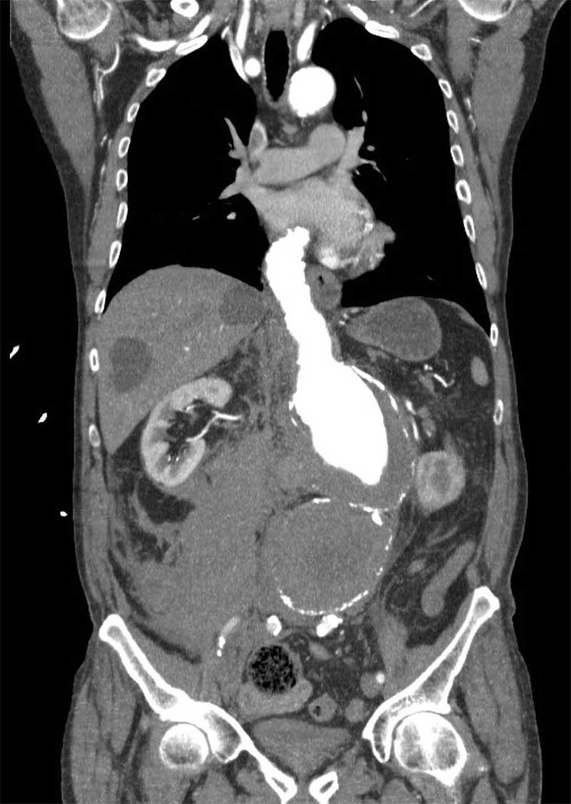 drsthanus's tweet photo. What is the main abnormality?

Other findings... https://t.co/ddotyphJxN