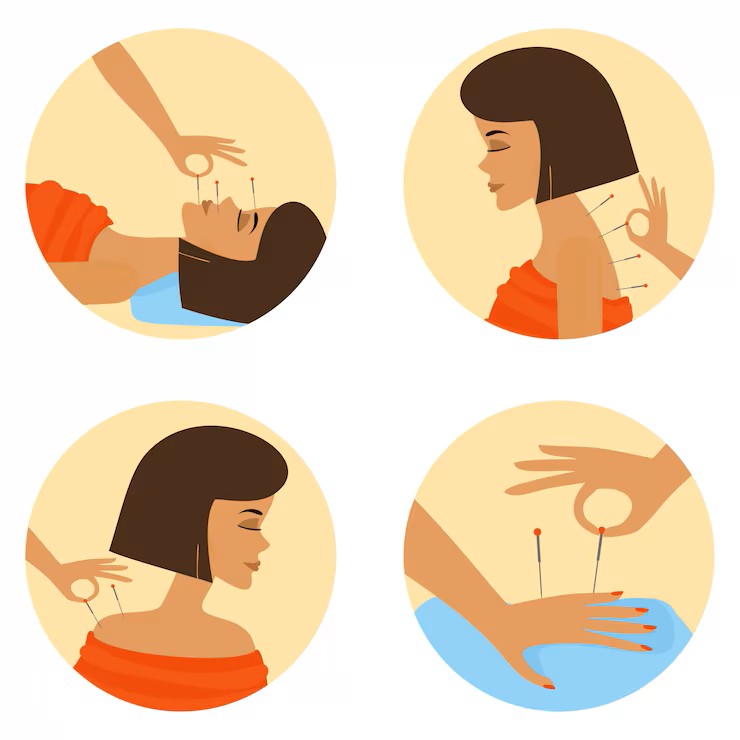 centrestphysio's tweet photo. 🌿 Rebalance Your Body, Naturally with Acupuncture 🌿📞 Call us at 403-274-1111 to book your appointment with a registered physiotherapist.
 🌐 You can also book online at https://t.co/3tlTlzsh1K
https://t.co/CZU3QdMZBL 🚗 https://t.co/TkTdy6FwXJ