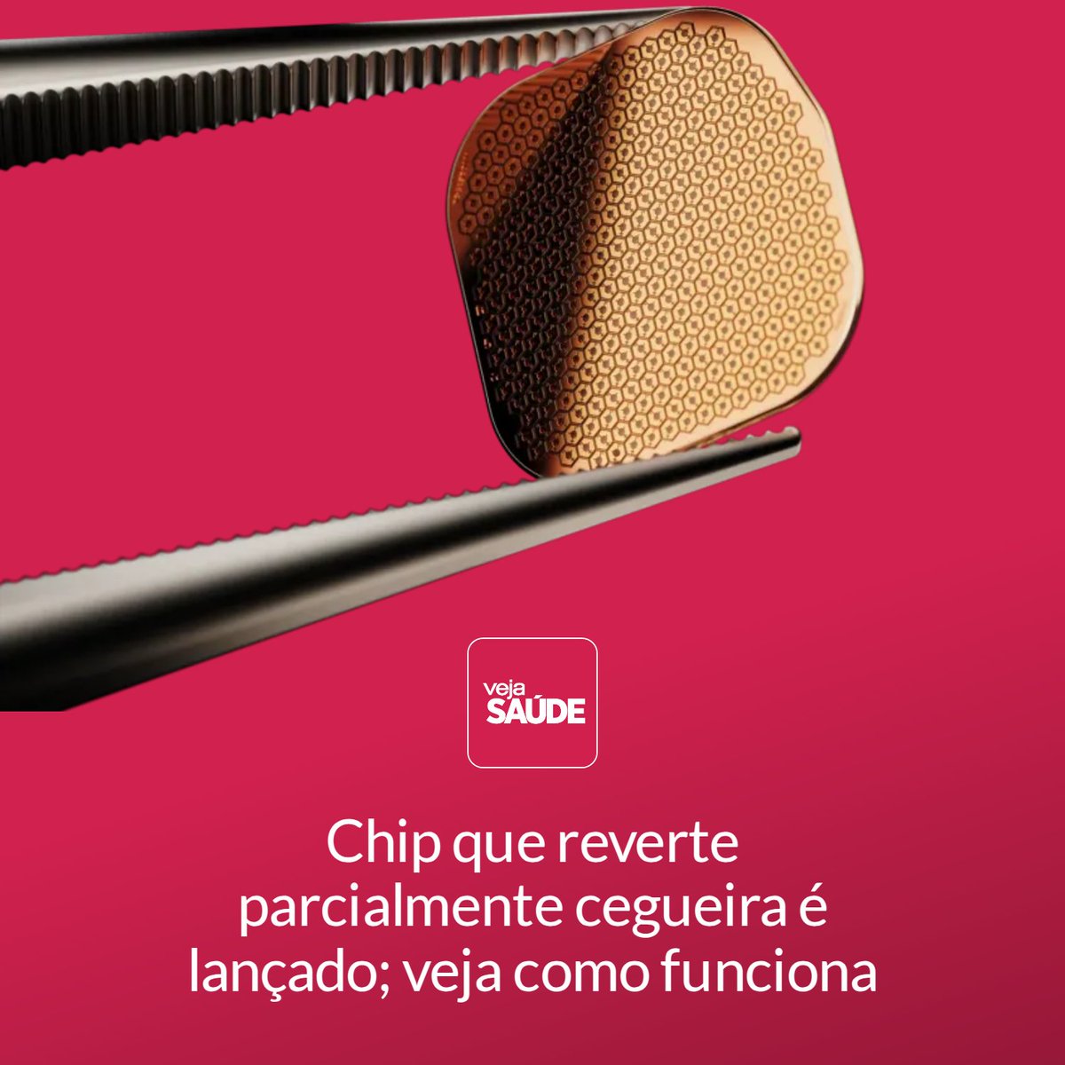 VejaSaude's tweet photo. Produto é implantado na retina de pessoas com degeneração macular relacionada à idade, principal causa de perda de visão no mundo

Leia mais em:
https://t.co/HmTTFdCAtm https://t.co/JTM1xExwI4