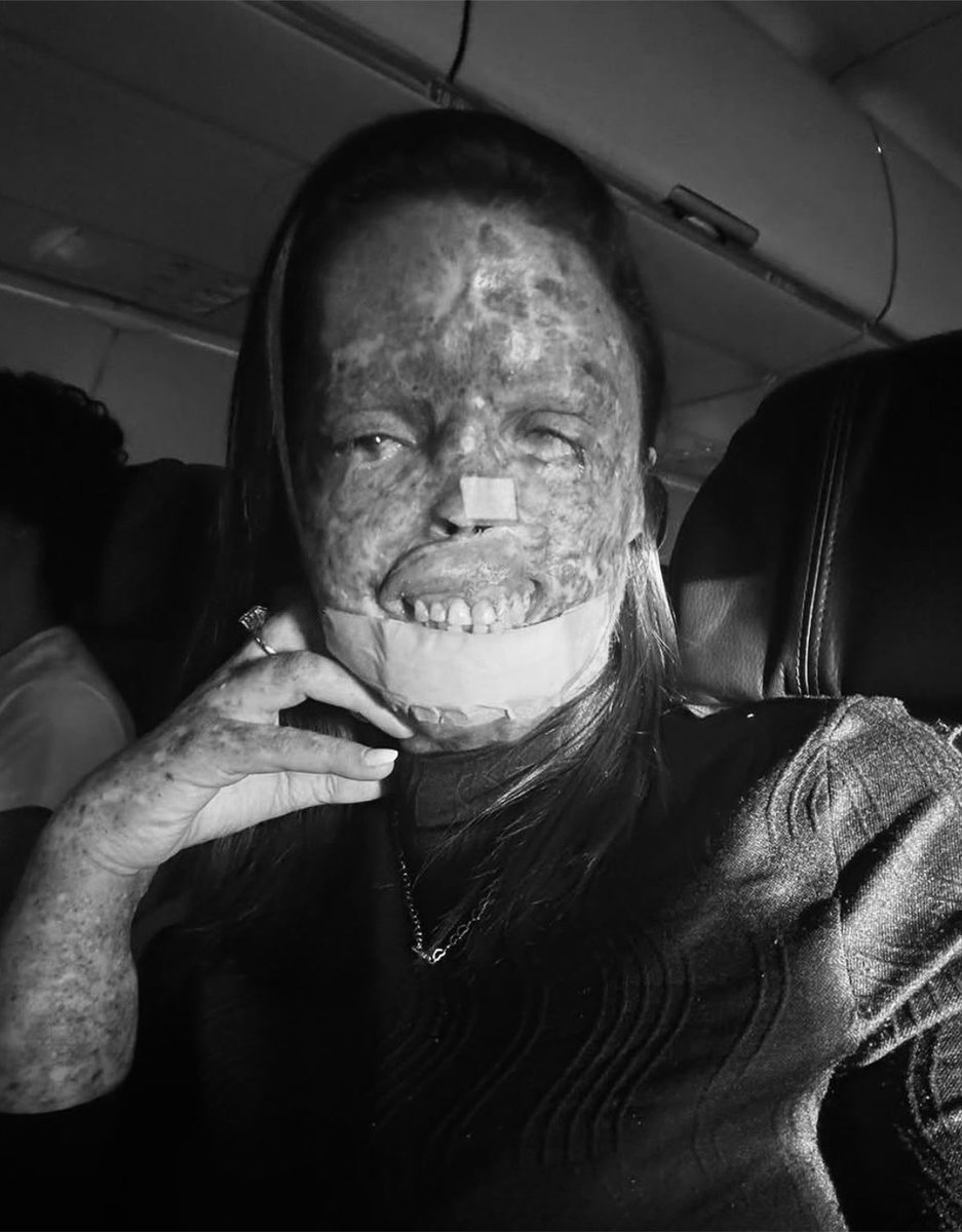 rindocasal's tweet photo. 🚨QUE TRISTEZA! A influenciadora cearense Kah Felipe morreu nesta sexta-feira (24), após enfrentar uma batalha contra uma doença genética rara.🥹💔 https://t.co/ZsHELn5nuB