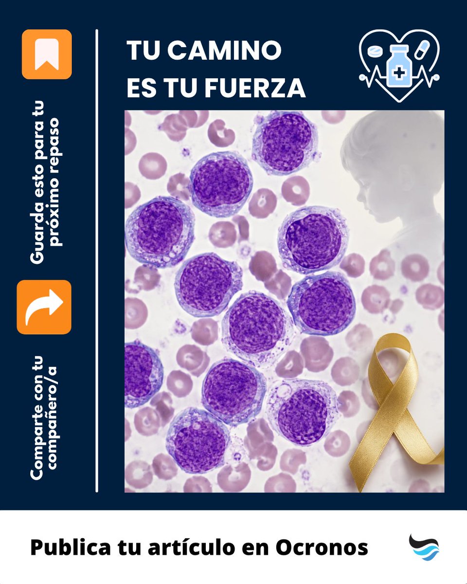 revistaocronos's tweet photo. Leucemia linfoide aguda: no todo dolor óseo infantil es banal.
Blastos linfoides, fiebre, adenopatías y profilaxis obligatoria del SNC.
Guárdalo para repaso rápido. 🩸 #Hematología #Medicina https://t.co/If89qlTOnQ