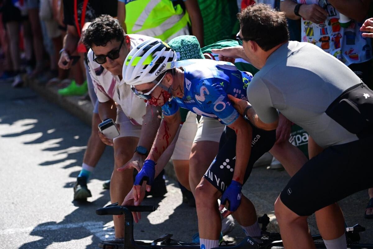 lequipe's tweet photo. Une vingtaine de points de suture pour Einer Rubio après son violent accident avec une voiture dans l'Alpe d'Huez

➡️ https://t.co/CEqsgMADc9 https://t.co/fLpONMitcJ