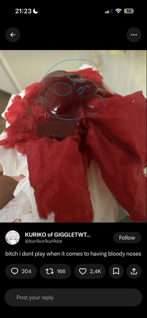 Angelic_Angel11's tweet photo. @kurikurikurikos Why does it have a face.. https://t.co/ToQ2FTg09T