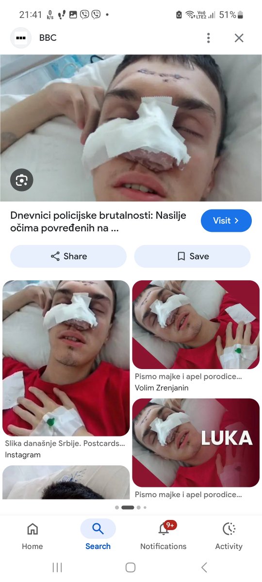 ssteffannus's tweet photo. Na dusi Dacica.

I to je tako.

Neka on optuzuje blokadere i sve nas da smo mi nesto krivi.

Istina je da je za tolko  tragedija 2025. na prvom mestu odgovoran ON.

Ovo dete oslobodjeno je svih optuzbi.
Proglasavan za ustasu pretrpeo je teske telesne povrede

KO JE ODGOVORAN? https://t.co/BhyHZKMi7u