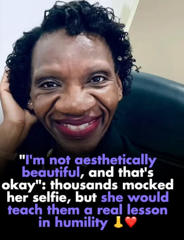Global_Folder's tweet photo. Naomie Pilula, a 37-year-old lawyer from Zambia, uploaded a photo without imagining what would come next. 

Within hours, hundreds of thousands of comments tore her apart: saying she was ugly, that she needed nose surgery. The kind of wave that can sink anyone.

She didn’t delete the photo. She didn’t respond with anger. She simply explained something no one expected: “It’s my father’s nose. Why would I want to get rid of something that reminds me of him?” With that sentence, everything changed direction.

Naomie told People that she does not consider herself “conventionally beautiful,” and she is at peace with that. Her faith and love for her family were the anchor that held her up when the entire internet seemed determined to bring her down. 

Today, that same photo that drew insults also turned her into a symbol of acceptance