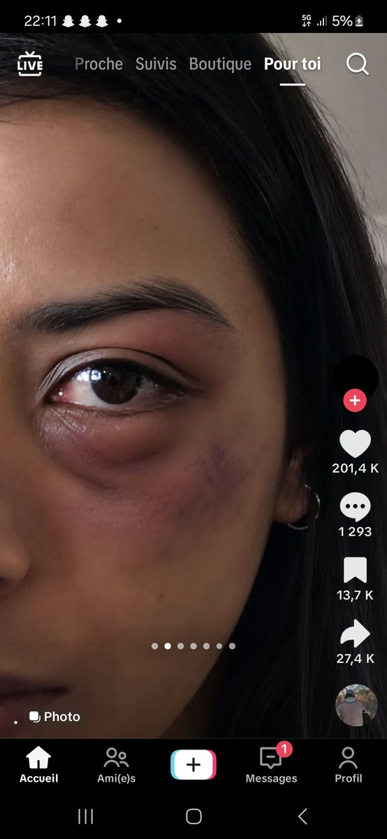Isma93120's tweet photo. N’ayez jamais honte ou peur du divorce , la seule honte qui existe c'est d'être violent envers sa compagne , la vie vaut mieux que l'amour https://t.co/2Oop2v0m0L