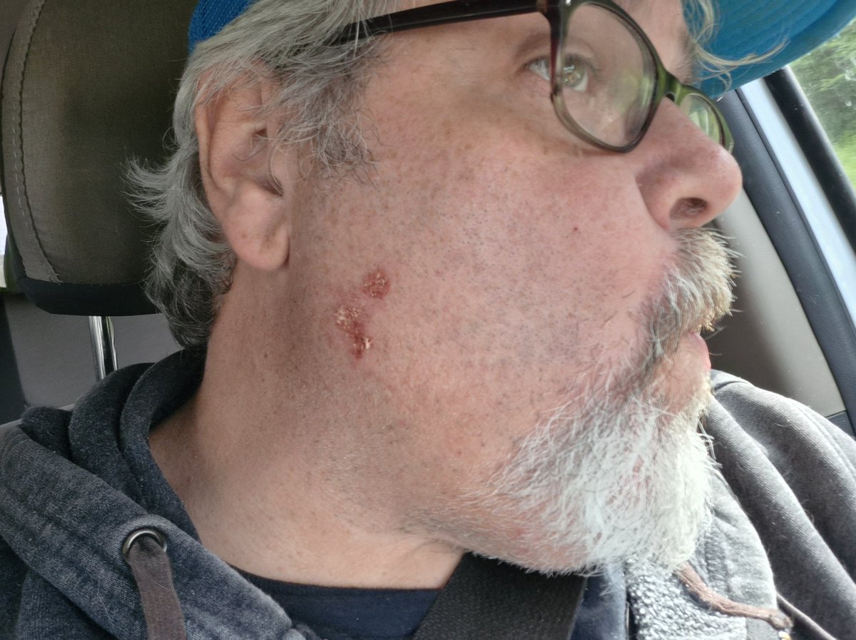 sensible's tweet photo. I actually had to pull a bit of my face off of my razor today https://t.co/UyzxHUI7VV
